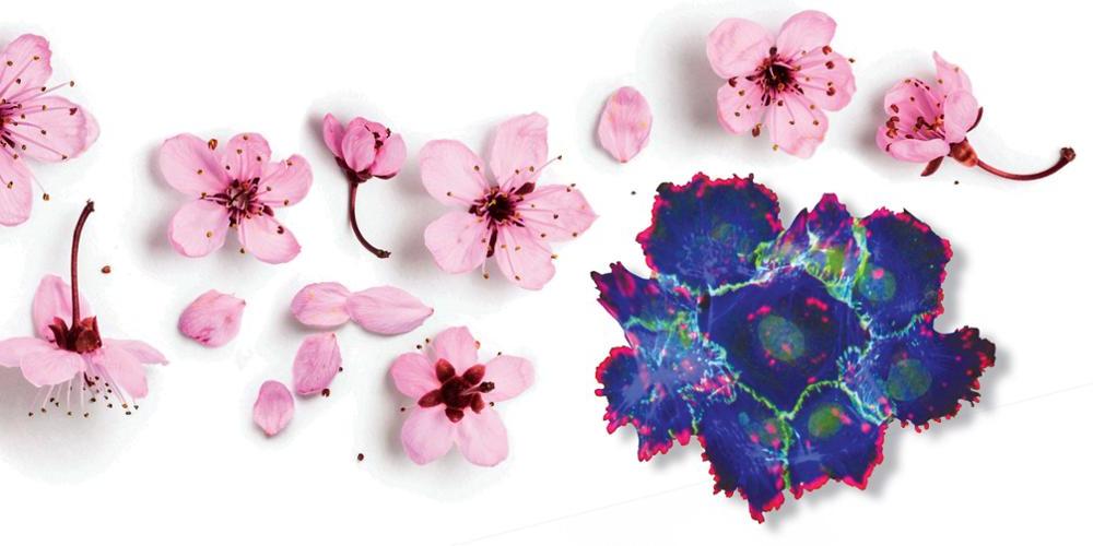 癌细胞的显微图像, 左下, 研究员Weiyi徐提醒道, 博士学位, 樱花.